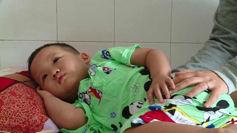 Gia tăng bệnh tay chân miệng ở trẻ