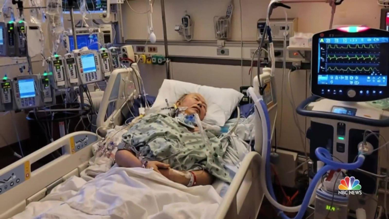 Mỹ ghép thành công phổi "COVID-19 cho COVID-19"