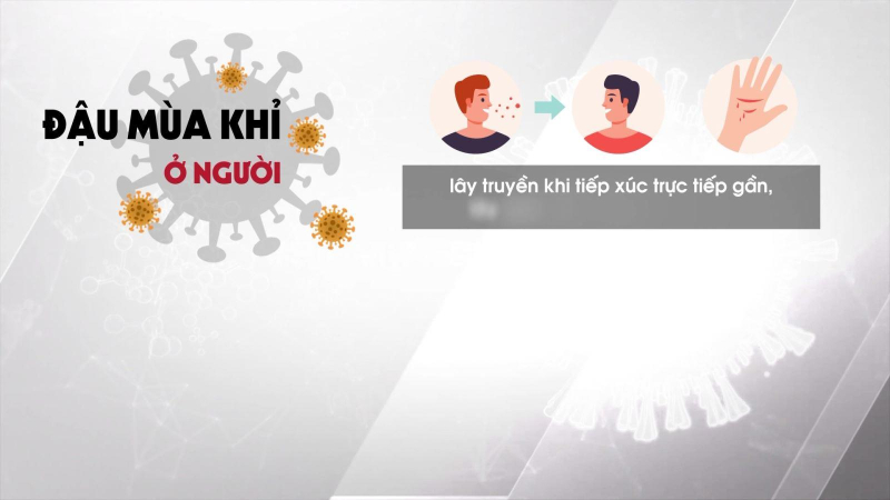 Nguy cơ xâm nhập đậu mùa khỉ vào Việt Nam