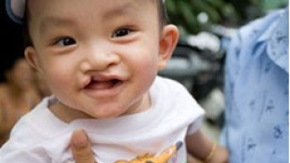 Khám, chữa bệnh miễn phí cho bệnh nhân bị khuyết tật