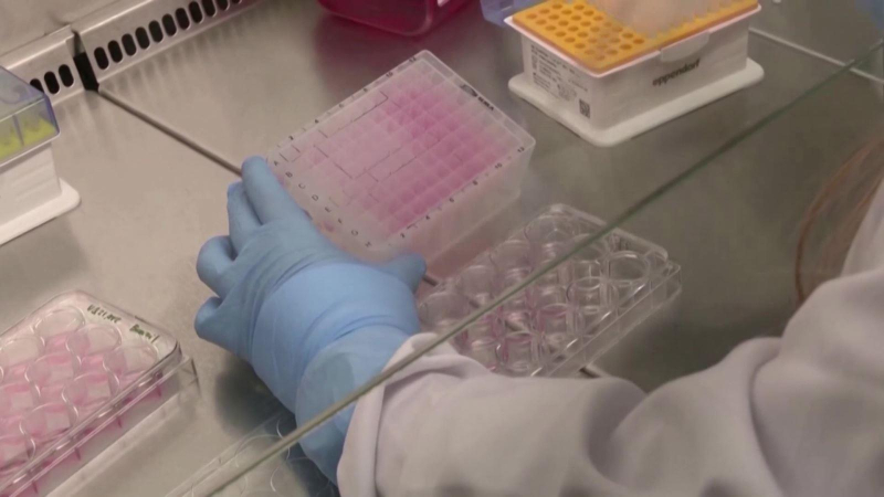 WHO kêu gọi hỗ trợ đổi tên bệnh đậu mùa khỉ