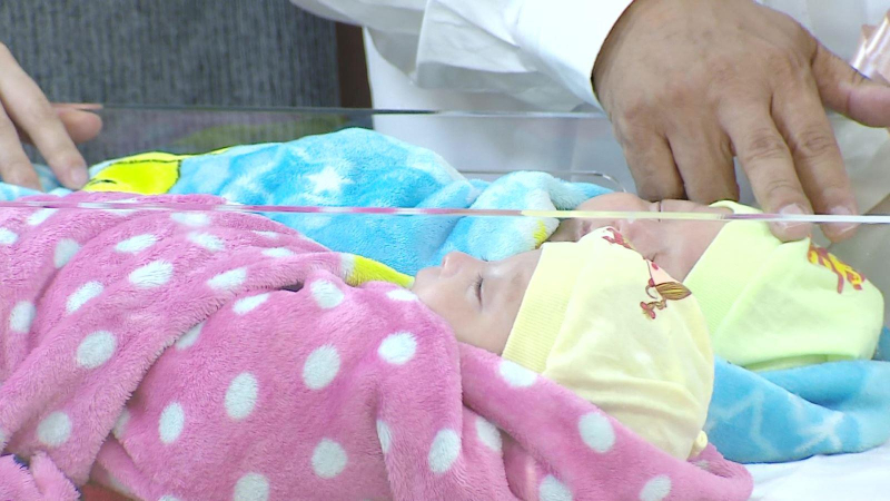 Kỳ tích nuôi sống cặp song sinh nhỏ nhất