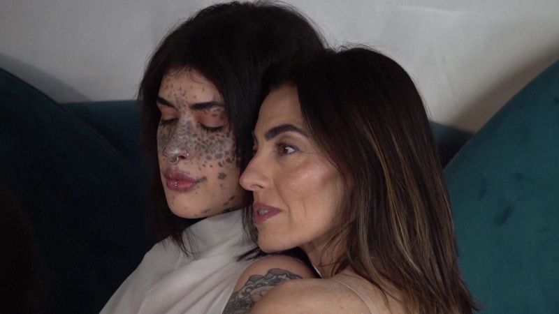 Vẻ đẹp &ldquo;kh&ocirc;ng ho&agrave;n hảo&rdquo; định nghĩa lại ng&agrave;nh thời trang Italy