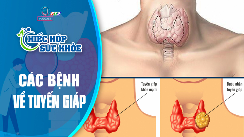 Dấu hiệu cảnh báo bệnh lý tuyến giáp