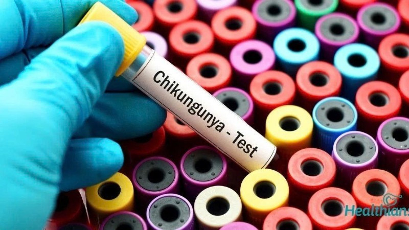 Bộ Y tế yêu cầu giám sát dịch bệnh Chikungunya ngay tại cửa khẩu