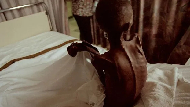 Phương Tây cắt giảm viện trợ có thể khiến hơn 22 triệu người tử vong