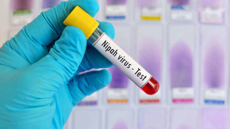 Chủ động ph&ograve;ng, chống bệnh do virus Nipah trong c&aacute;c cơ sở y tế