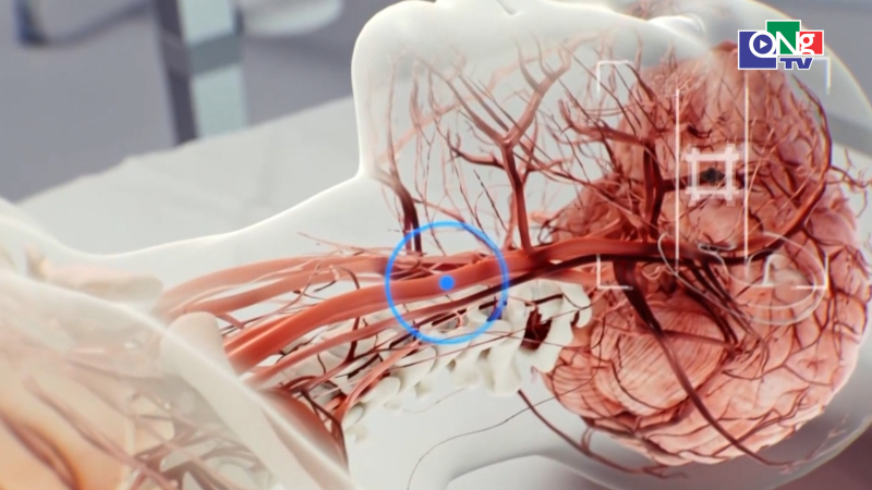 Robot si&ecirc;u nhỏ gi&uacute;p tan m&aacute;u đ&ocirc;ng 