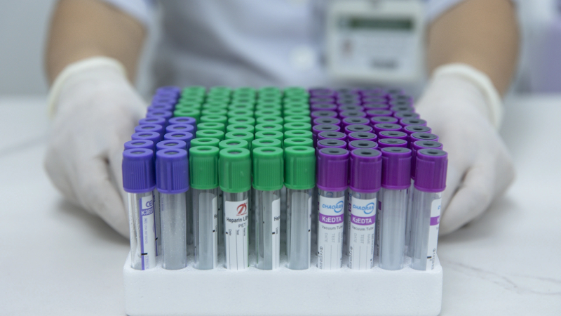 Bệnh &aacute;n điện tử giảm x&eacute;t nghiệm tr&ugrave;ng lặp 