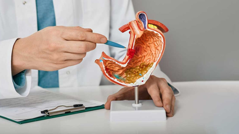N&ecirc;n chủ động tầm so&aacute;t ung thư dạ d&agrave;y, nhất l&agrave; người tr&ecirc;n 40 tuổi 